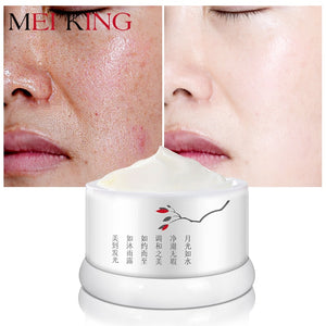 Default Title - MEIKING Anti Aging Face Cream Anti Acne Pimple Spot Resveratrol Moisturizing Facial Cream Whitening Beauty Skin Care Cream 30g