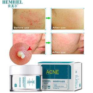 Default Title - HEMEIEL Herbal Anti-Acne Cream Oily Skin Acne Stains Moisturizing Acne Treatment Face Cream Care Acne Scar Remove Blackhead
