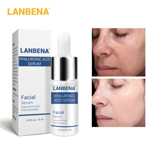 [variant_title] - LANBENA Hyaluronic Acid Serum Blackhead Removing Moisturizing Acne Treatment Skin Care Repair Whitening AntiAnging Winkles 15ml