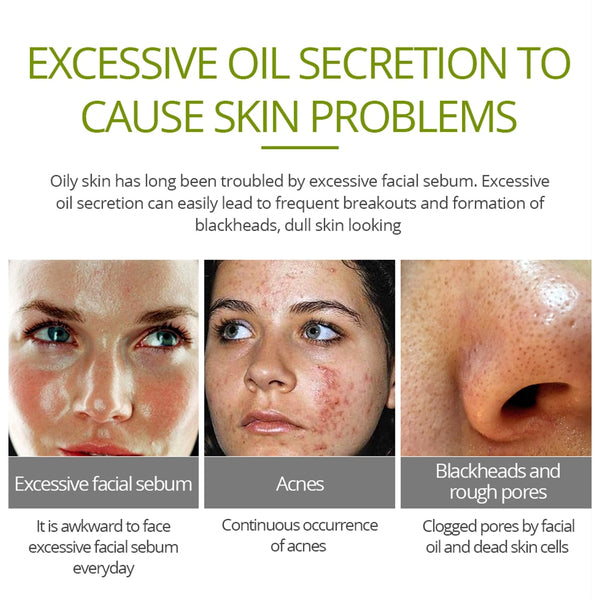 [variant_title] - VIBRANT GLAMOUR Tea Tree Acne Cream Anti-acne Print Face Cream Remover Acne  Treatment Facial Eliminates Oil Control Skin Care