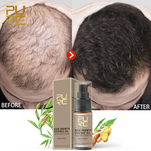 [variant_title] - PURC Hot sale Fast Hair Growth Essence Oil Hair Loss Treatment Help for hair Growth Hair Care 20ml
