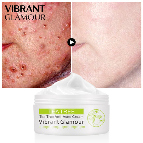 Default Title - VIBRANT GLAMOUR Tea Tree Acne Cream Anti-acne Print Face Cream Remover Acne  Treatment Facial Eliminates Oil Control Skin Care